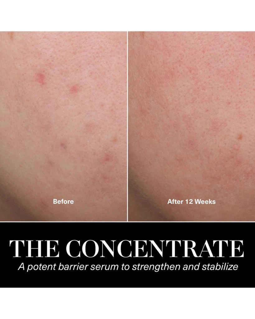 The Concentrate - Soothing & Strengthening Face Serum 商品