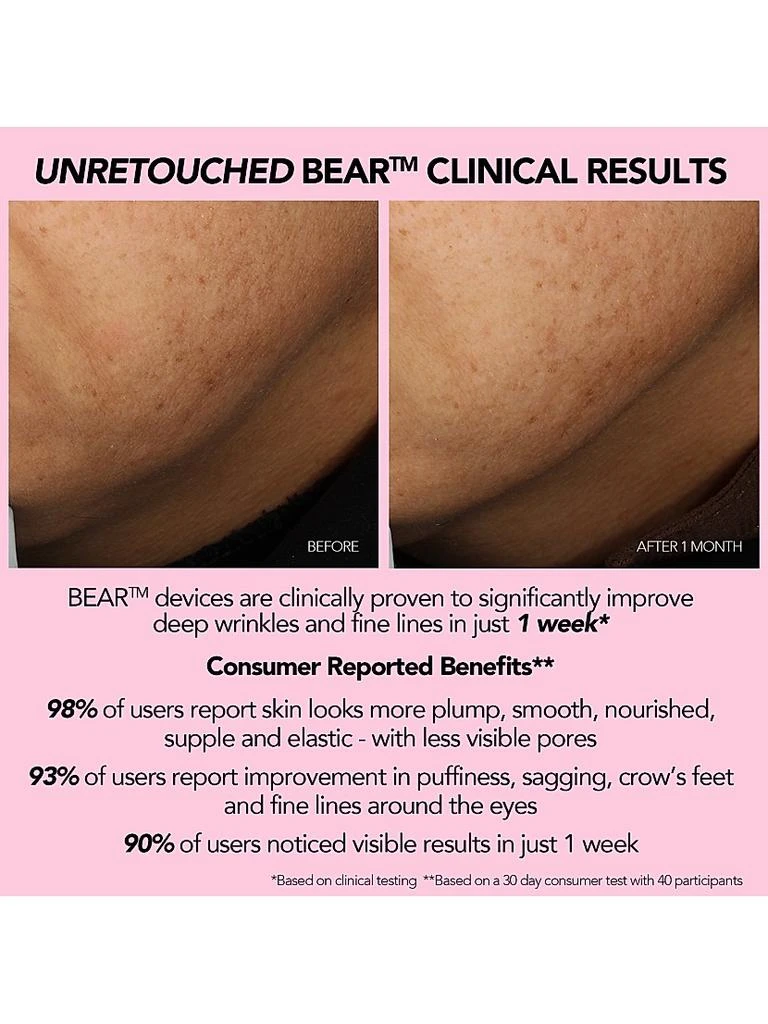 BEAR Smart Microcurrent Facial Toning Device 商品