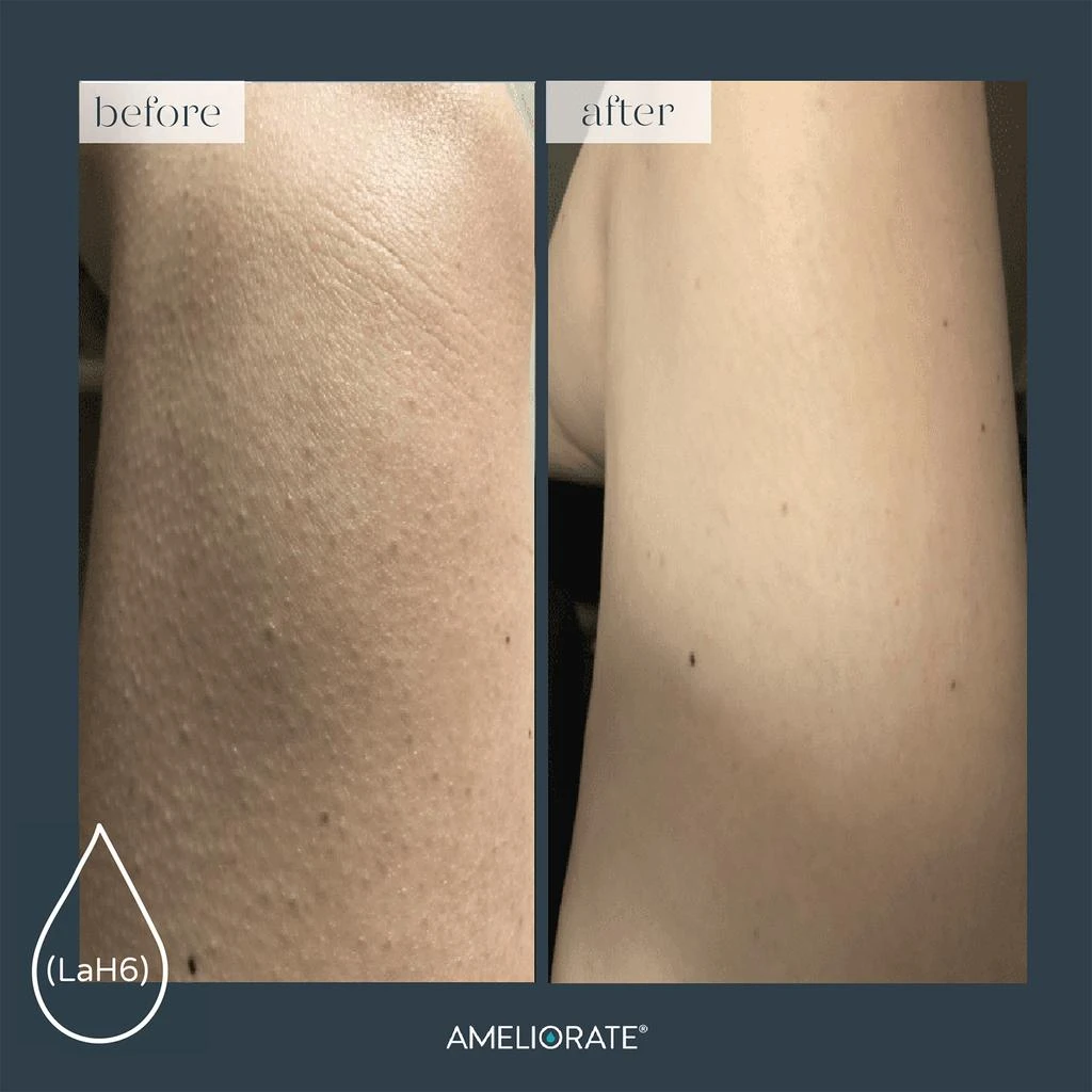 商品Ameliorate|AMELIORATE Transforming Body Lotion 100ml,价格¥158,第2张图片详细描述