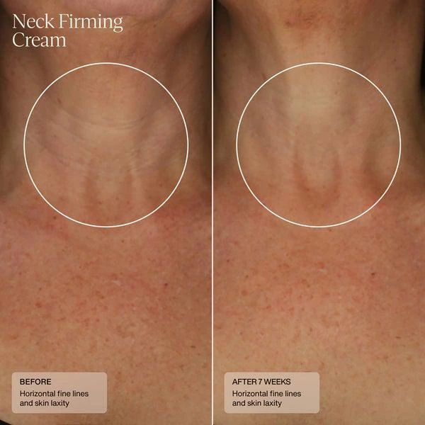 商品SENTÉ|SENTÉ Neck Firming Cream 50ml,价格¥779,第2张图片详细描述