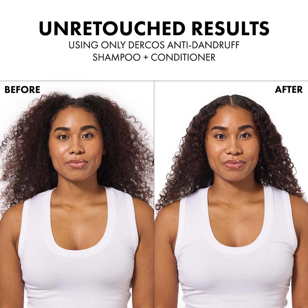 Vichy Dercos Selenium Sulfide Anti-Dandruff Shampoo 商品