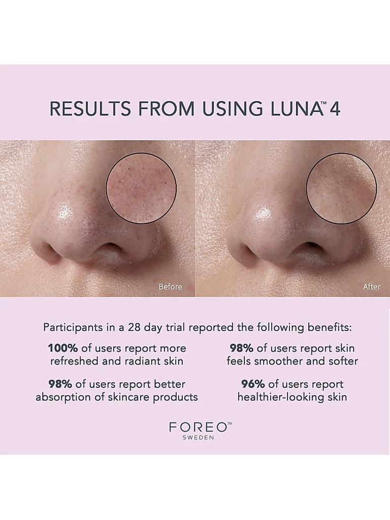 Luna 4 Facial Cleansing & Firming Device For Sensitive Skin 商品