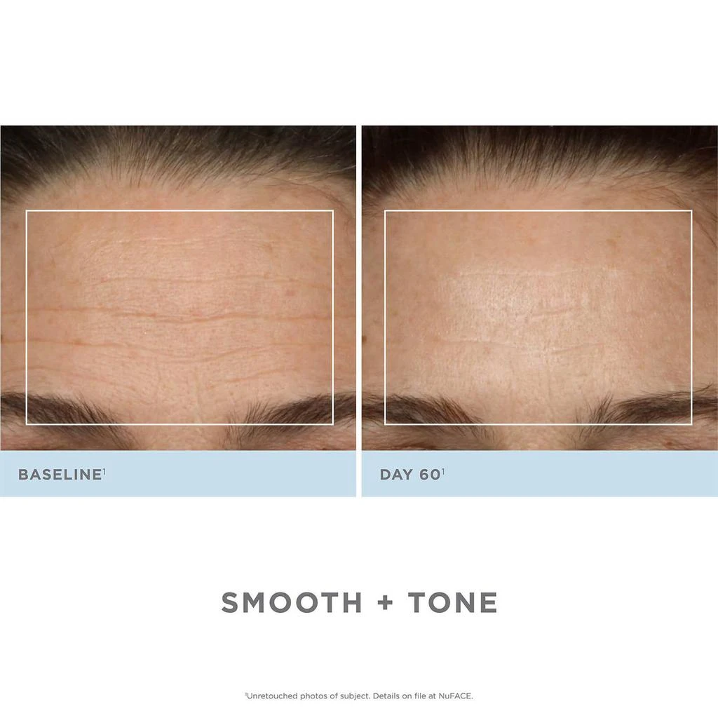 NuFACE Trinity + Trinity Wrinkle Reducer Attachment Set 商品