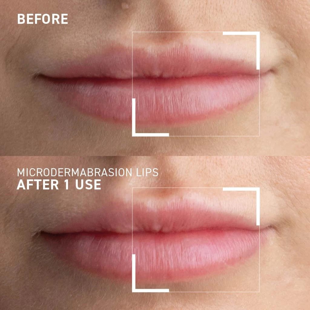 商品Dr. Brandt Skincare|SMOOTHING LIP EXFOLIATOR,价格¥227,第2张图片详细描述