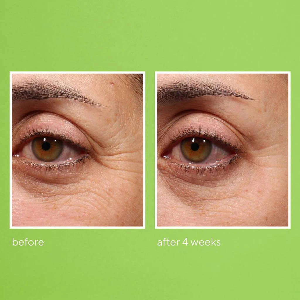 商品Murad|Murad Retinol Youth Renewal Eye Serum 0.5 oz,价格¥658,第5张图片详细描述