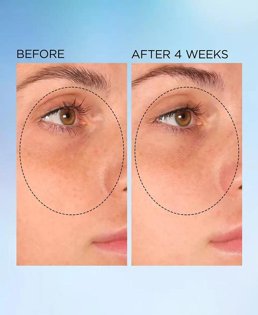 Visible Brightening Clearly Radiant Spot Correcting Capsules, 30 capsules 商品