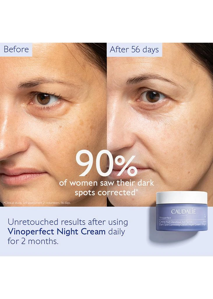 商品Caudalie|Vinoperfect Anti-Dark Spot Radiance Serum Vitamin C Alternative 50ml,价格¥352,第2张图片详细描述
