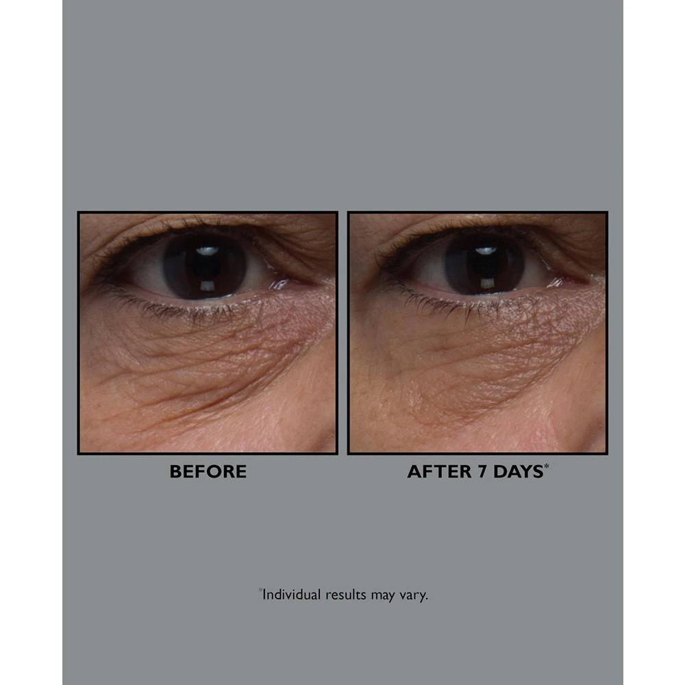 商品Peter Thomas Roth|FIRMx Collagen Eye Cream,价格¥500,第3张图片详细描述