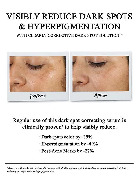 Clearly Corrective Dark Spot Solution商品第9张图片规格展示