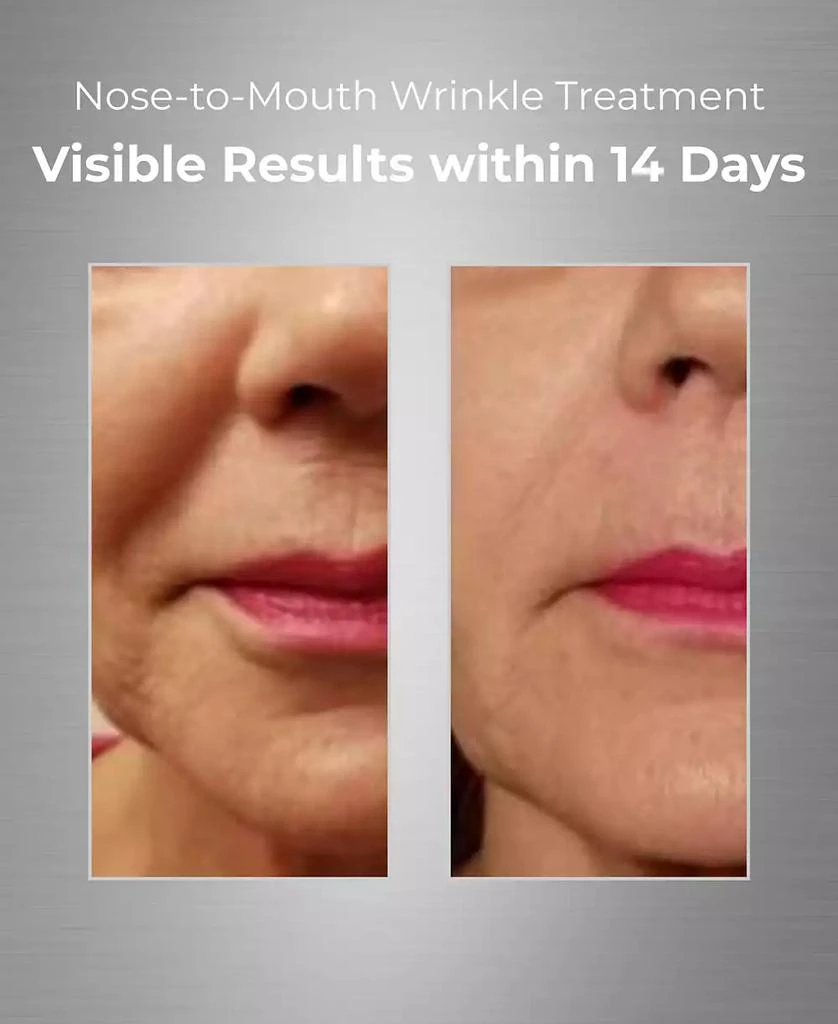 商品Bionova|Nose-To-Mouth Wrinkle Treatment With UV Chromophores,价格¥537,第4张图片详细描述