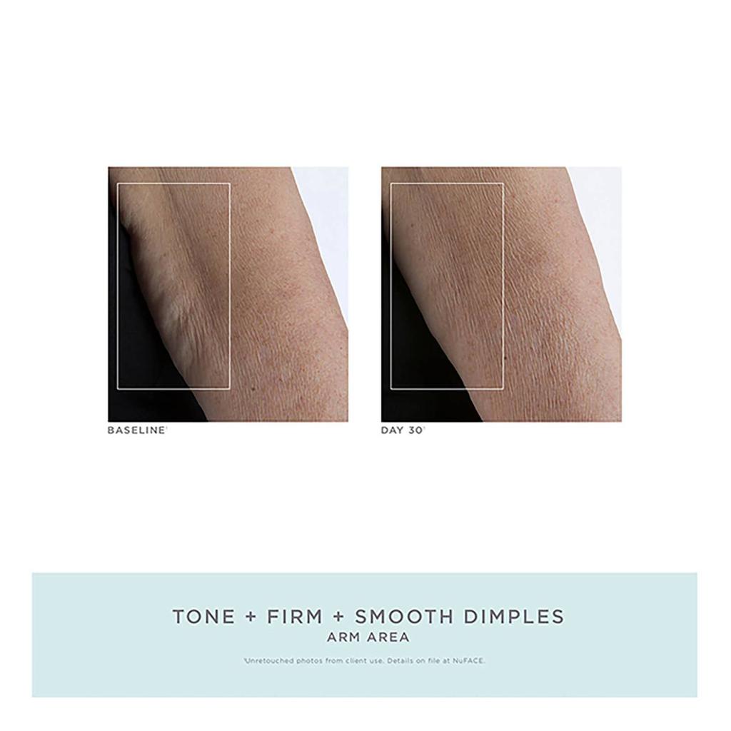 NuFACE NuBODY Skin Toning Device商品第5张图片规格展示