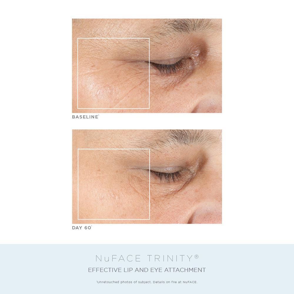NuFACE Trinity® Complete Facial Toning Kit ($623 VALUE)商品第2张图片规格展示