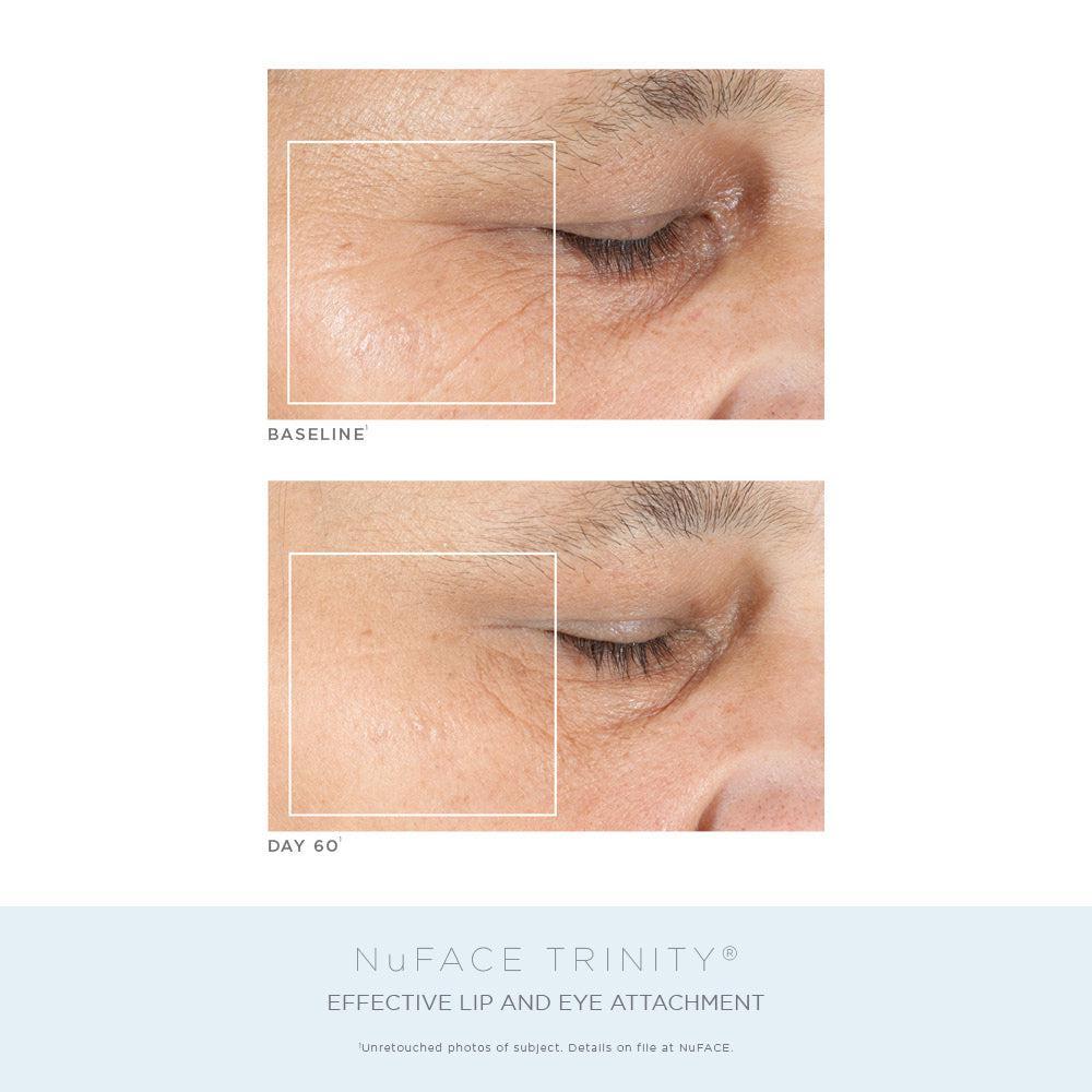商品NuFace|NuFACE Trinity® Complete Facial Toning Kit ($623 VALUE),价格¥3865,第4张图片详细描述
