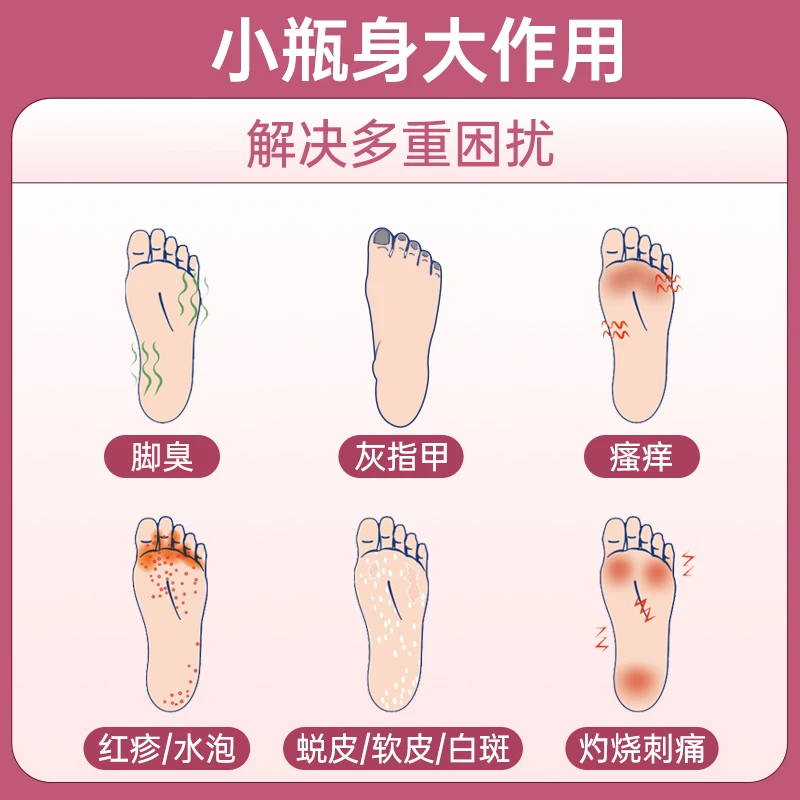 日本小林制药脚气真菌水止痒脱皮杀菌抗真菌治疗灰指甲水脚气膏 商品
