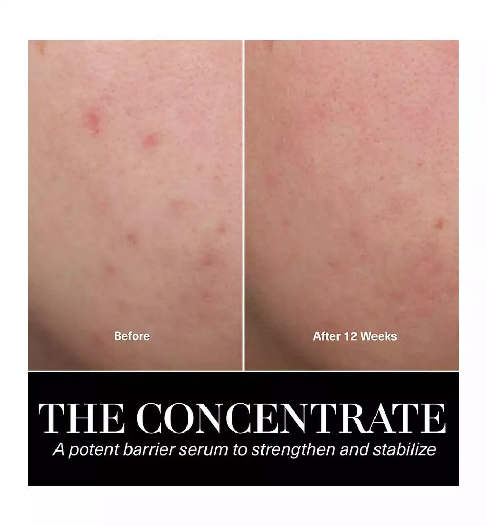 商品La Mer|The Treatment Lotion, 5 oz.,价格¥1005,第3张图片详细描述