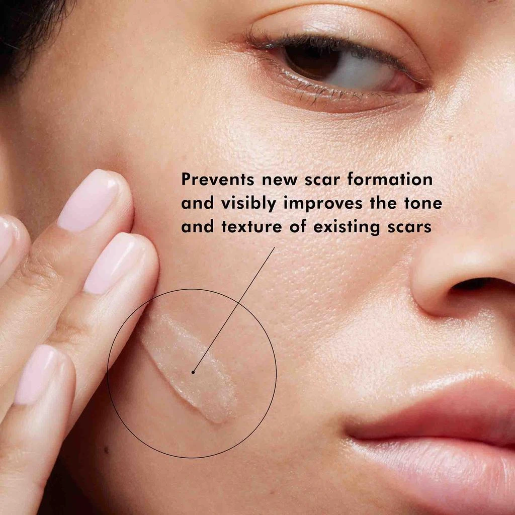 商品SkinCeuticals|SkinCeuticals Advanced Scar Control Skin Protectant Gel,价格¥950,第4张图片详细描述