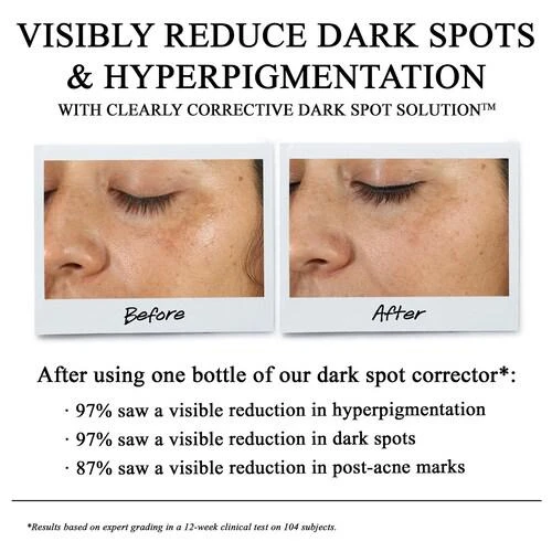 商品Kiehl's|Clearly Corrective Dark Spot Correcting Serum,价格¥169,第2张图片详细描述