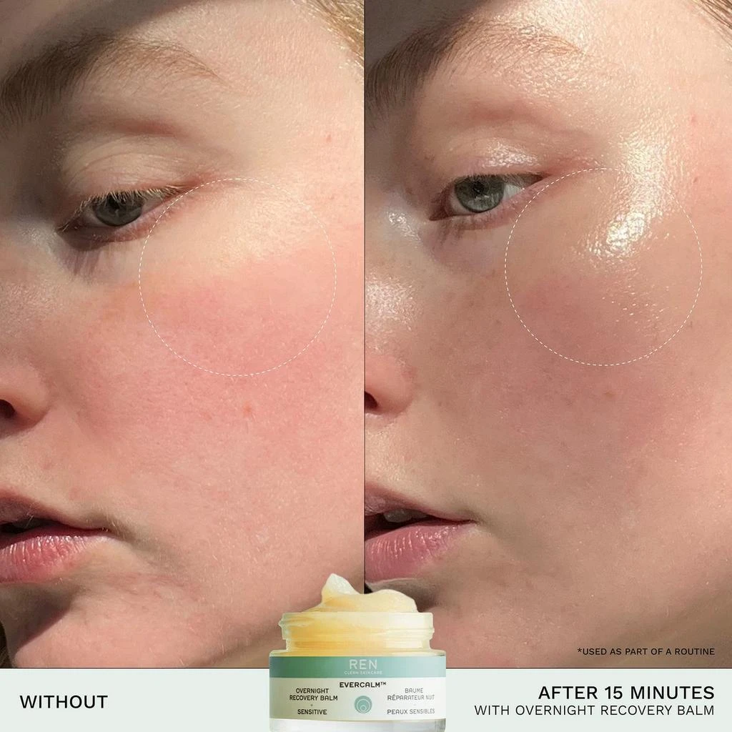商品REN Clean Skincare|REN Clean Skincare Evercalm Overnight Recovery Balm,价格¥458,第2张图片详细描述