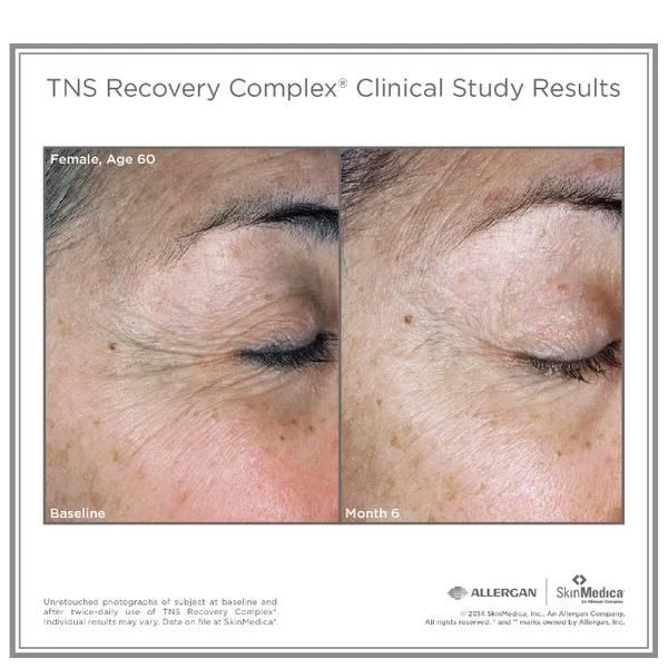 商品SkinMedica|SkinMedica TNS Recovery Complex,价格¥1453,第3张图片详细描述