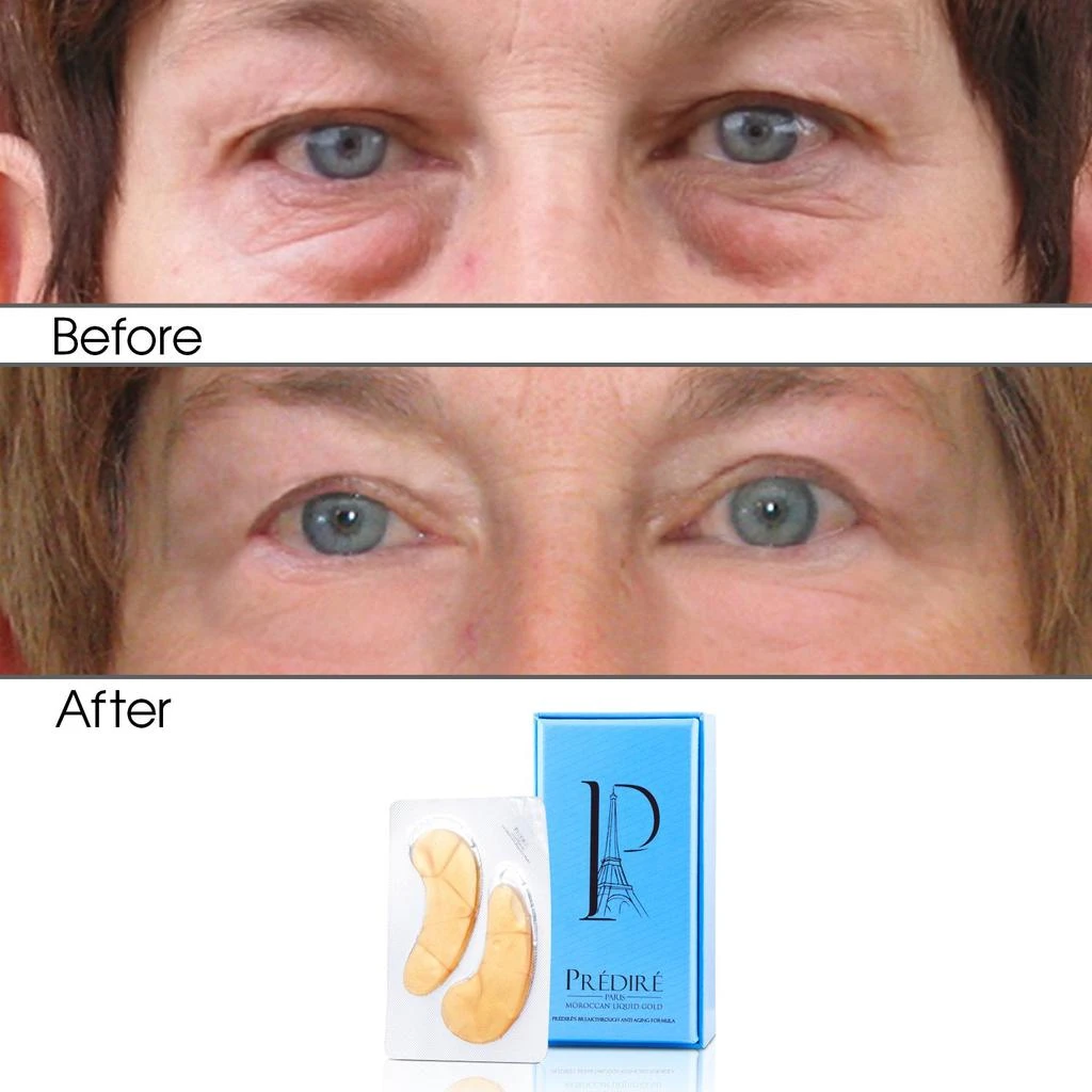 商品Predire Paris|12-in-1 Collagen Cell Renewal & Oxygen/Vitamin Eye Masks,价格¥239,第4张图片详细描述