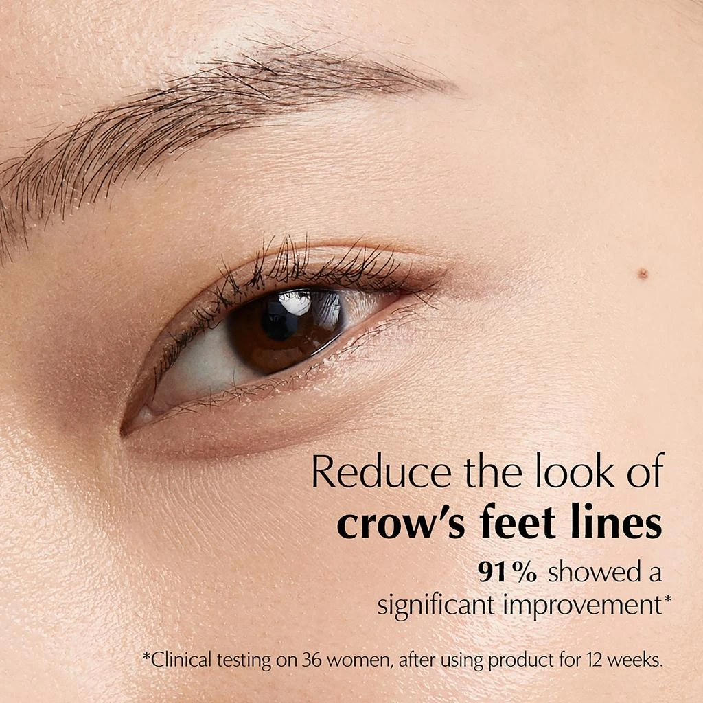 商品Estée Lauder|Estée Lauder Advanced Night Repair Eye Concentrate Matrix Synchronized Recovery Complex 15ml,价格¥692,第4张图片详细描述