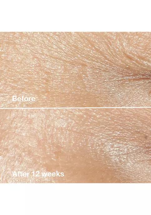 Smart Clinical Repair™ Wrinkle Correcting Cream商品第4张图片规格展示