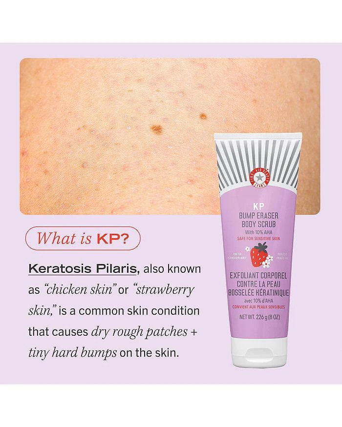 商品First Aid Beauty|KP Bump Eraser Body Scrub with 10% AHA Body Exfoliant for Keratosis Pilaris - Strawberry,价格¥89,第4张图片详细描述