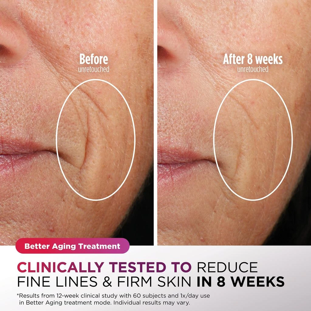 Shark Beauty CryoGlow Under- Eye Cooling + LED Anti-Aging & Skin Clearing Face Mask 商品