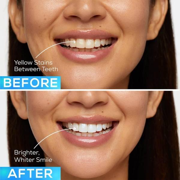 GLO Science GLO Lit Teeth Whitening GLO Vials - 7 GLO Vials and Lip Care商品第6张图片规格展示