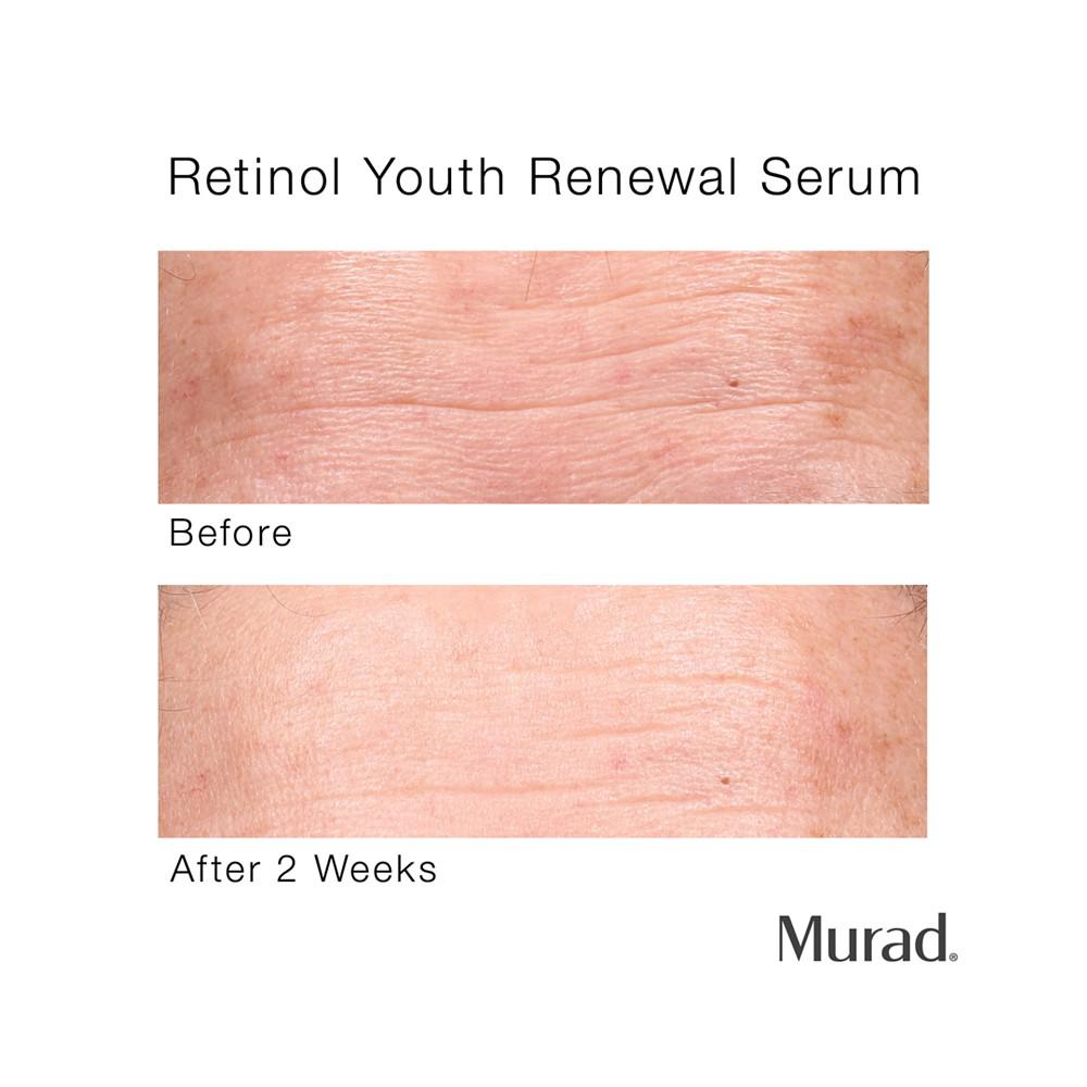 Resurgence Retinol Youth Renewal Serum, 0.33-oz.商品第3张图片规格展示