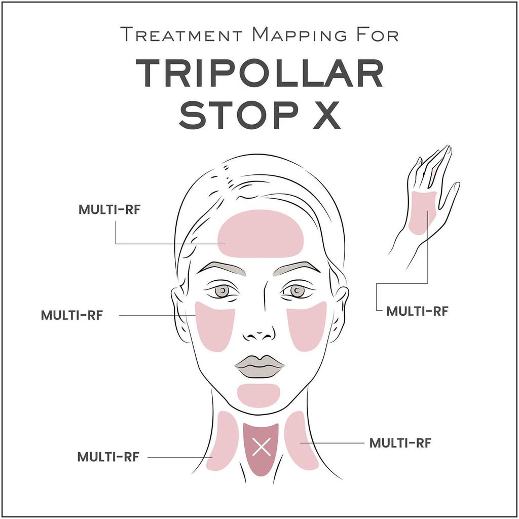 玫瑰金限定版 TriPollar Stop X 射频美容仪 - Rose Gold商品第4张图片规格展示