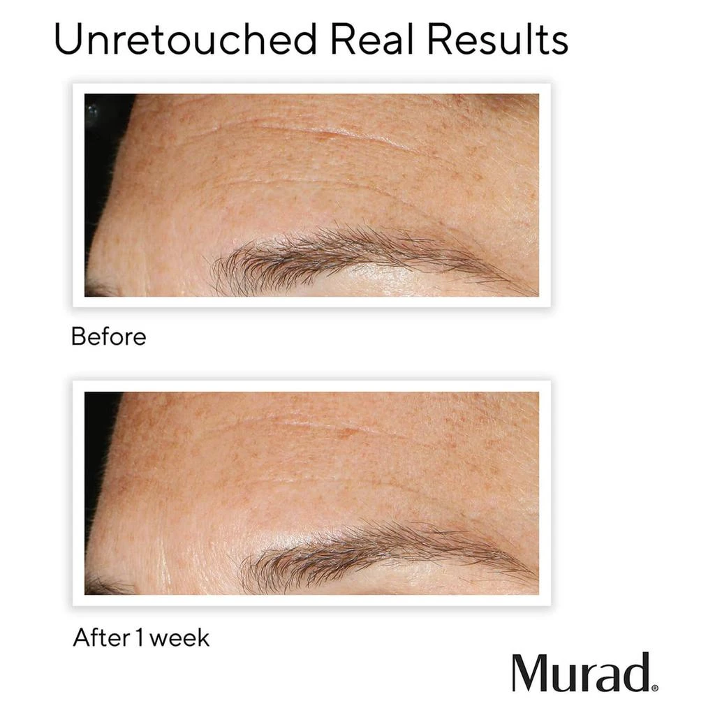 商品Murad|Murad Replenishing Multi-Acid Peel 100ml,价格¥482,第4张图片详细描述