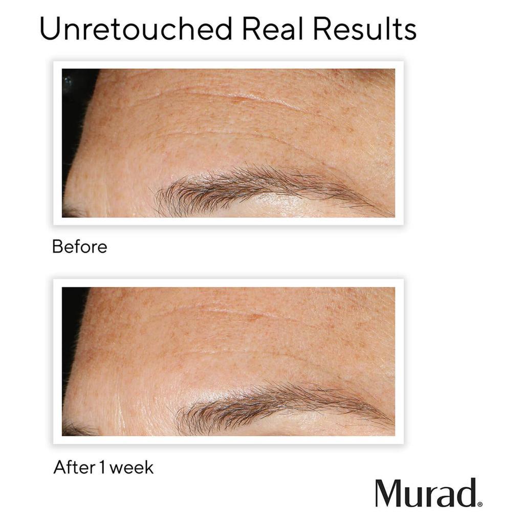 商品Murad|Murad Replenishing Multi-Acid Peel 100ml,价格¥435,第6张图片详细描述
