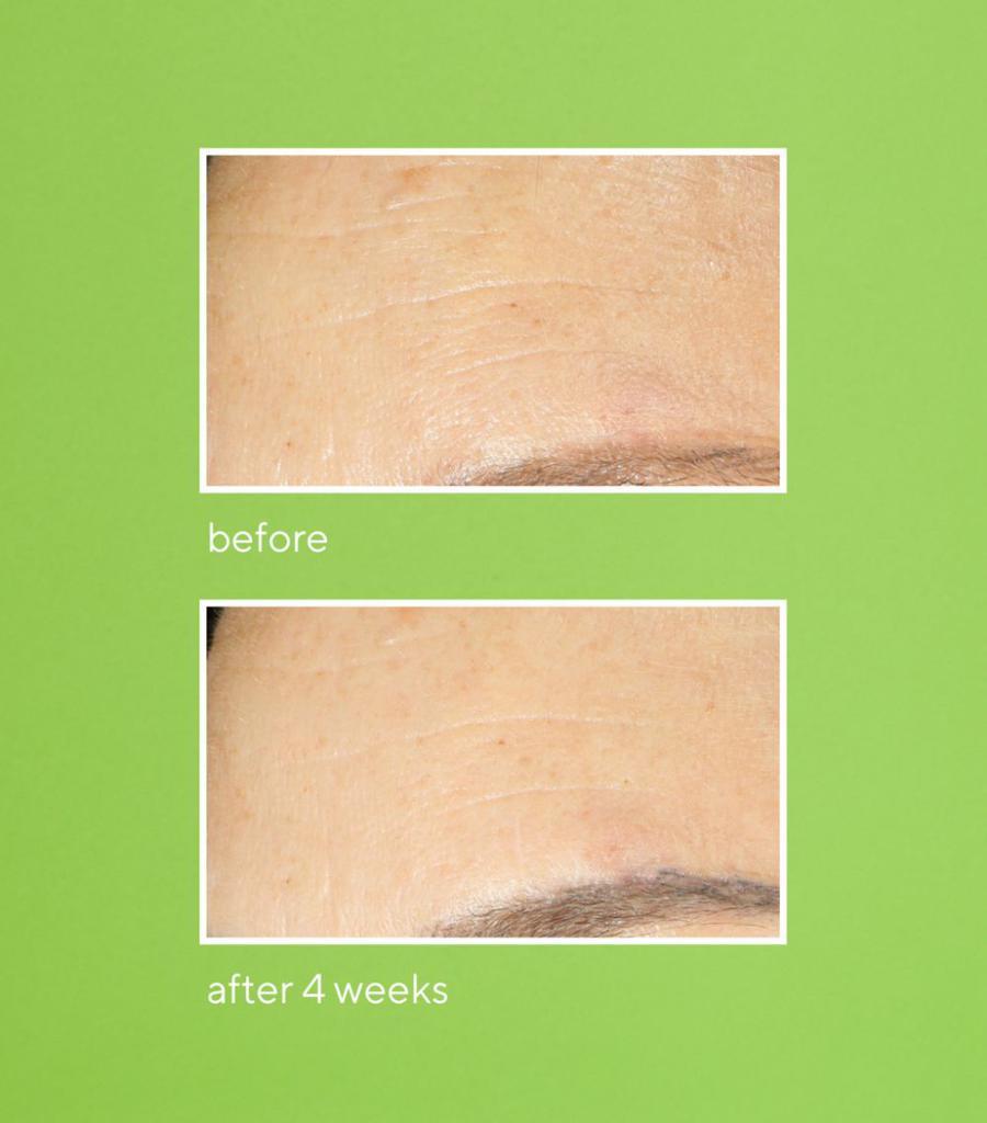 商品Murad|Murad Retinol Youth Rene Nitcrem 20,价格¥656,第7张图片详细描述