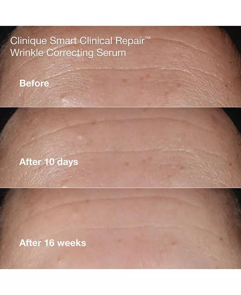 商品Clinique|Wrinkle-Fighting Routine Skin Care Gift Set,价格¥622,第4张图片详细描述