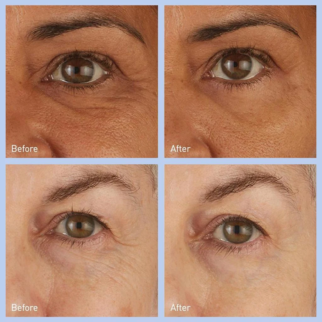 商品skyn ICELAND|skyn ICELAND Hydro Cool Firming Eye Gels,价格¥167,第3张图片详细描述