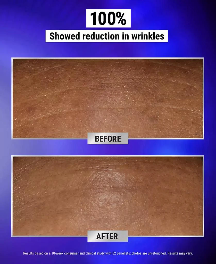 商品Kiehl's|Retinol Fast Release Wrinkle-Reducing Night Serum, 0.94 oz.,价格¥562,第4张图片详细描述