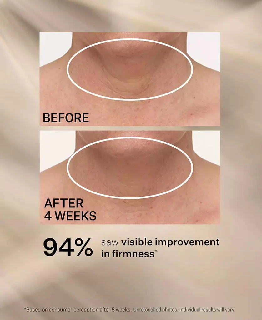 TL Advanced Tightening Neck Cream Plus With Alpha-3 Peptide, 3.4 oz. 商品