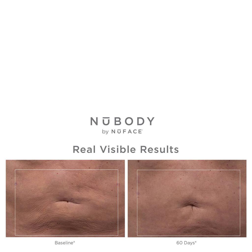 NuFACE NuBODY Skin Toning Device商品第7张图片规格展示