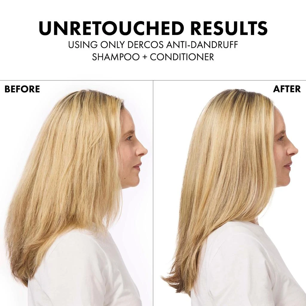 Vichy Dercos Selenium Sulfide Anti-Dandruff Shampoo 商品