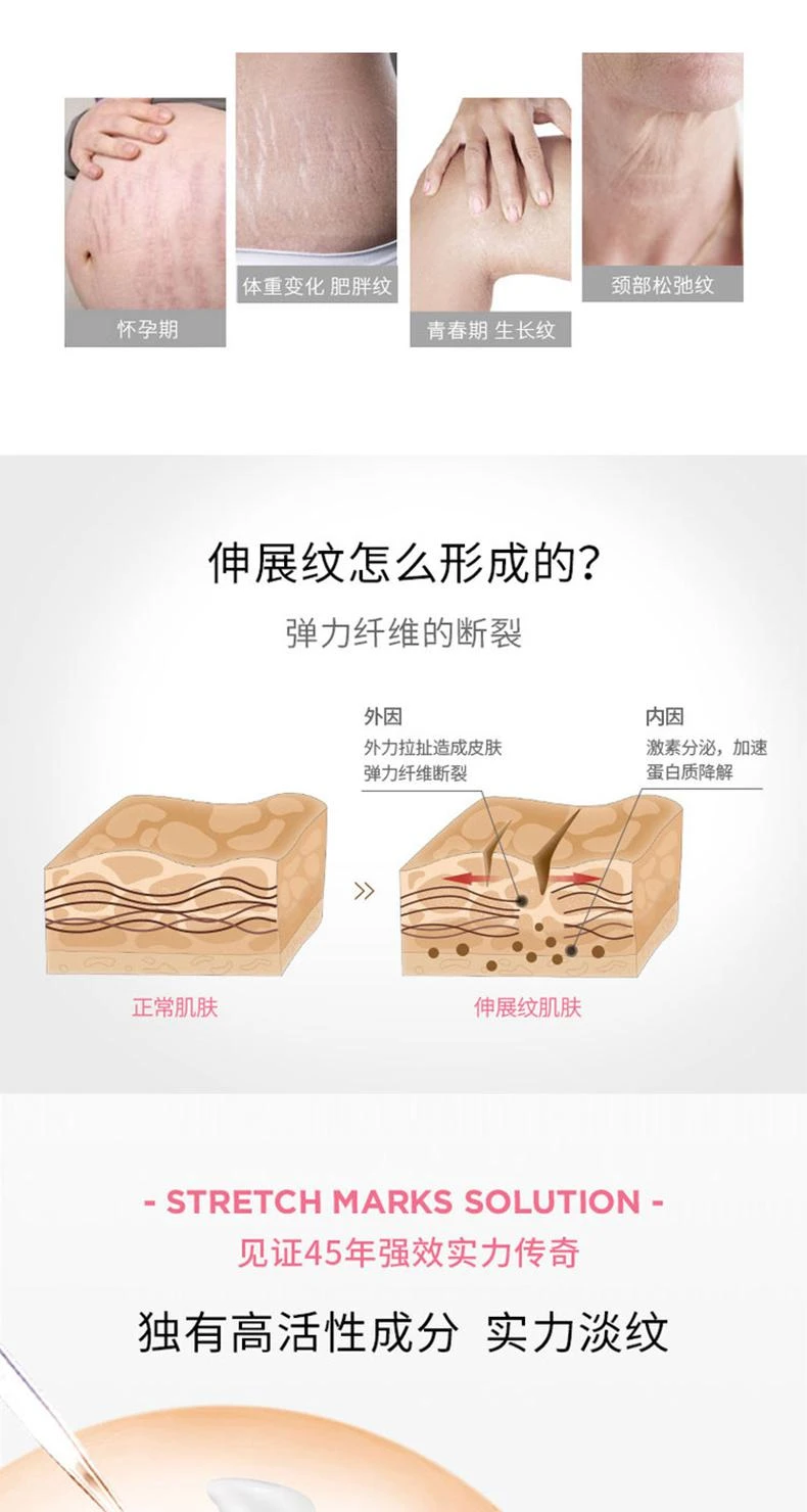 商品Lierac|欧洲直邮LIERAC丽蕾克「身体抚纹烫斗」妊娠纹精华75mlx2产后修护,价格¥375,第2张图片详细描述