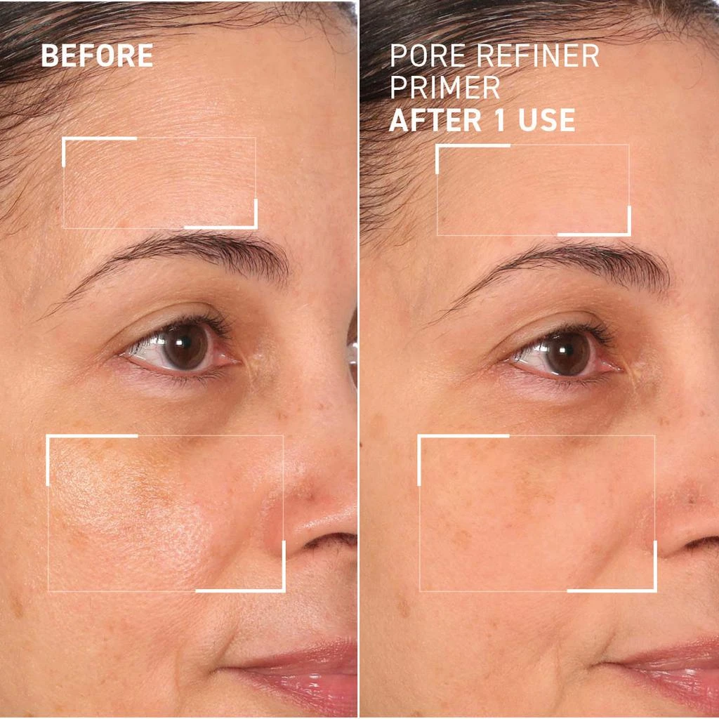 商品Dr. Brandt Skincare|PORE REFINER PRIMER,价格¥363,第5张图片详细描述
