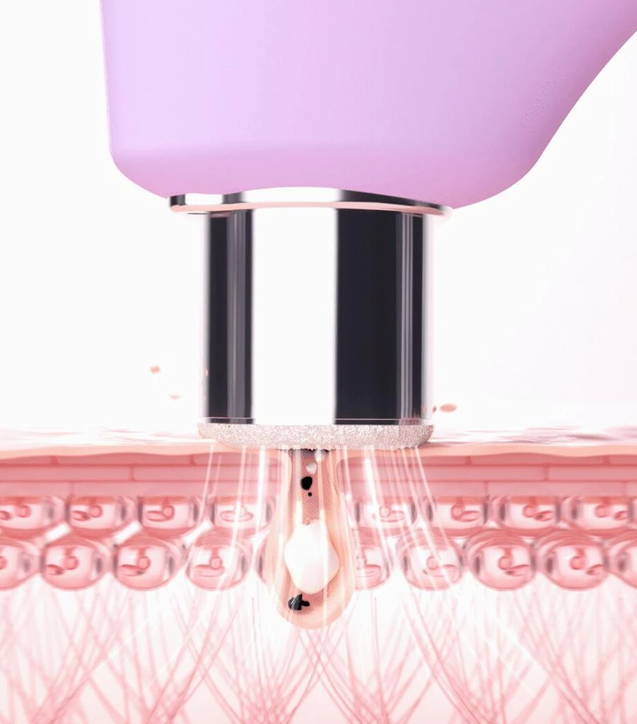 商品Foreo|Kiwi Derma Diamond Microdermabrasion and Pore Vacuum Device,价格¥1643,第3张图片详细描述