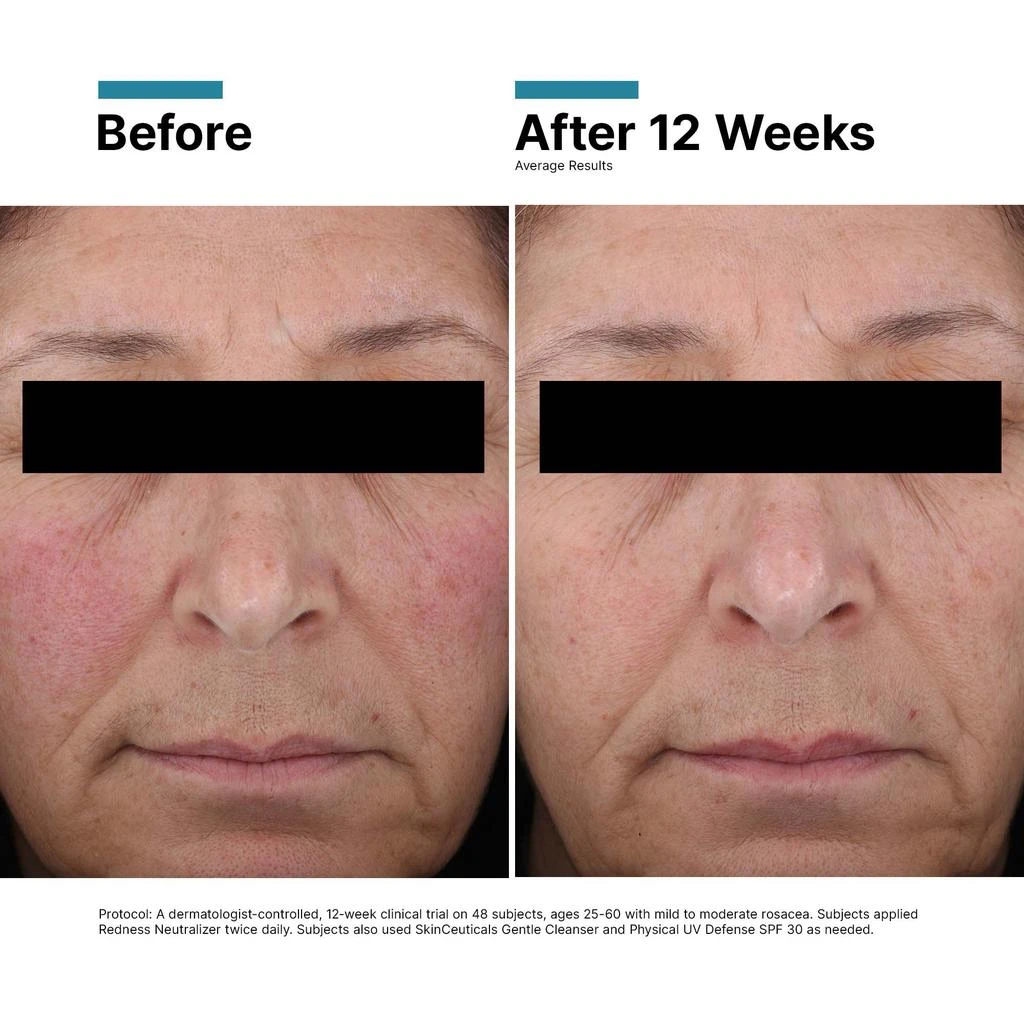 SkinCeuticals Redness Neutralizer 商品