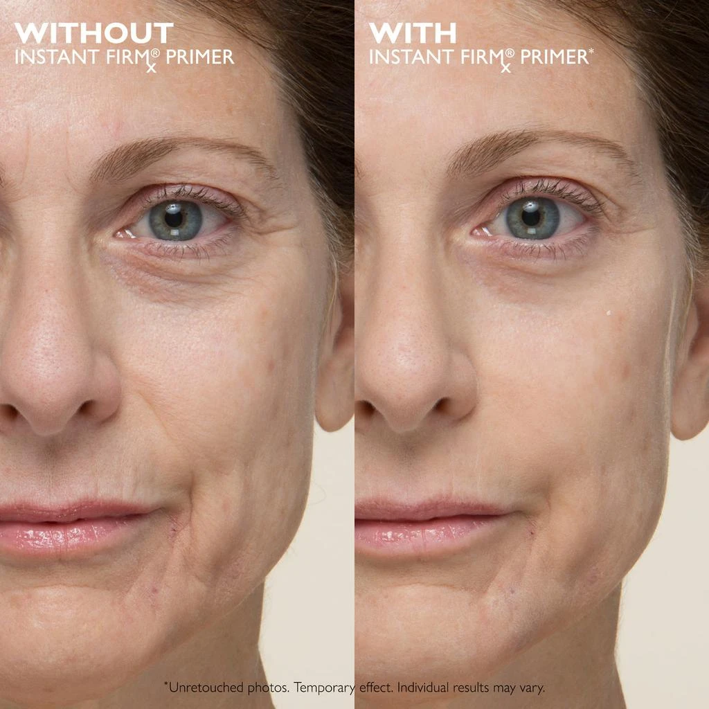 商品Peter Thomas Roth|Instant FIRMx No-Filter Firming Primer|30 ml / 1.0 fl oz,价格¥317,第2张图片详细描述