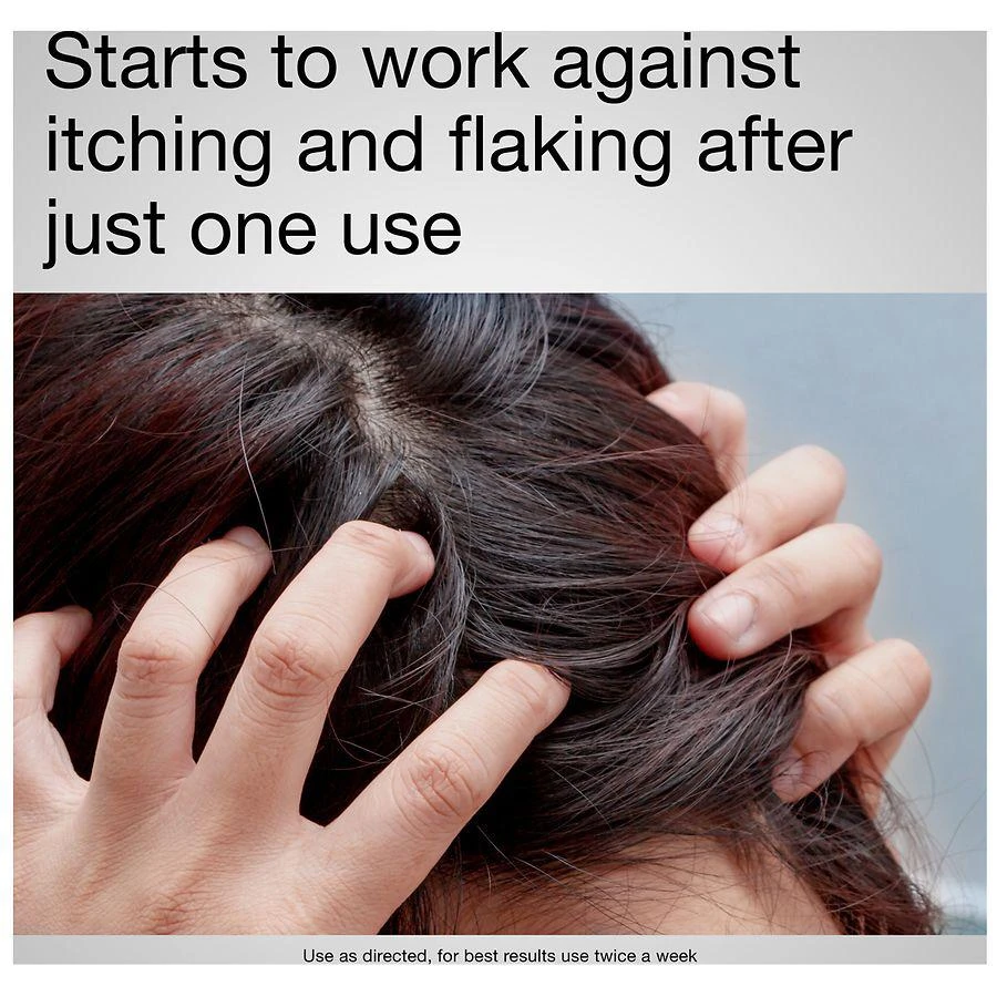 T-Gel Therapeutic Dandruff Treatment Shampoo 商品