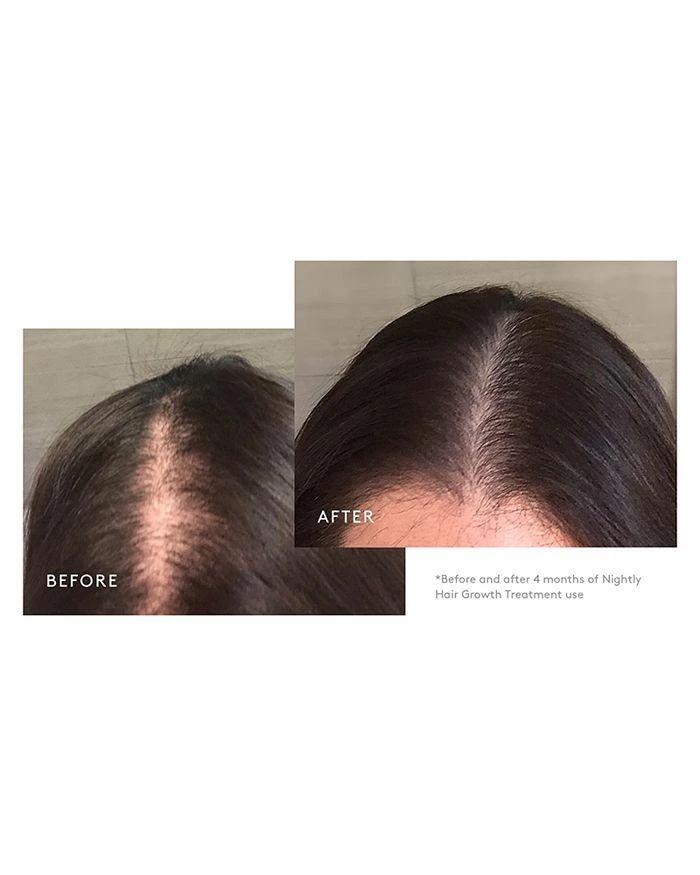 商品VIRTUE|Flourish Nightly Intensive Hair Growth Treatment - 90 Days,价格¥1048,第2张图片详细描述