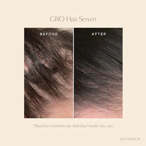 商品Vegamour|GRO Hair Serum & Biotin Gummies Set for Thinning Hair,价格¥593,第1张图片详细描述