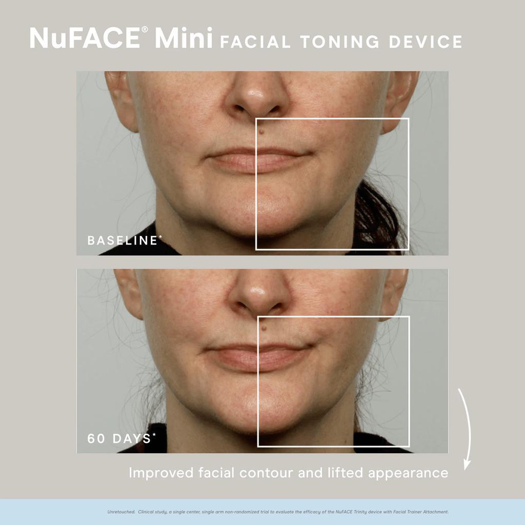 商品NuFace|MINI Facial Toning Device,价格¥1563,第4张图片详细描述