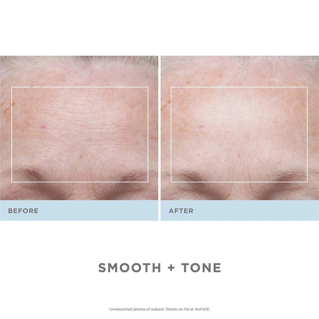商品NuFace|NuFACE Trinity + Trinity Wrinkle Reducer Attachment Set,价格¥4115,第5张图片详细描述